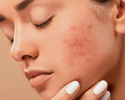 Skin Problems Guide: Your Ultimate Solution